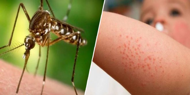 من بينها حشرة قرمزية.. وحمى غرب النيل..     فيروسات تهدد الإنسان والحيوان تتفشى "فجأة".. !!